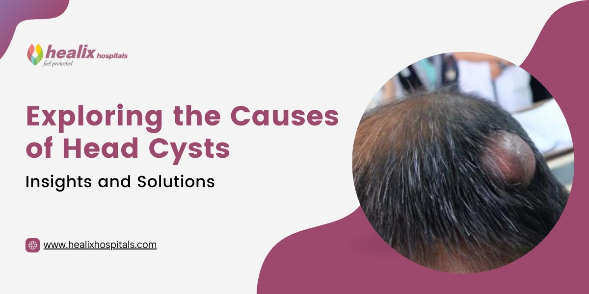 Exploring the Causes of Head Cysts: Insights and Solutions